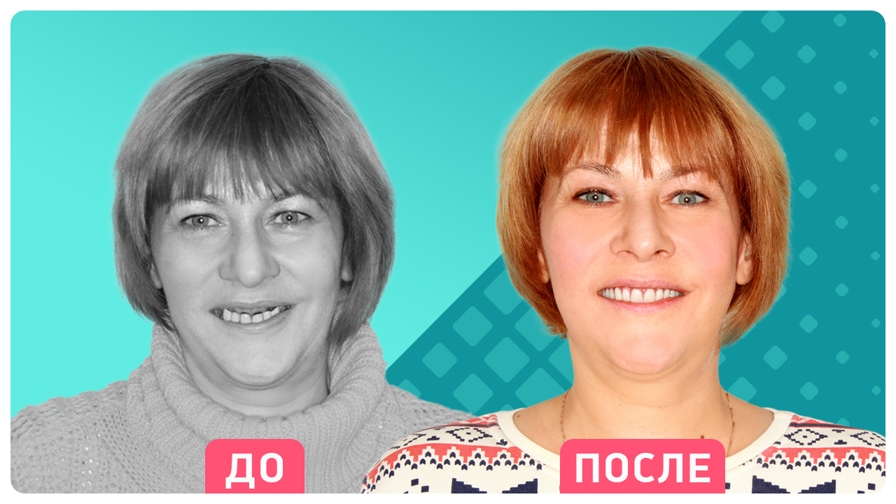 Ольга Пыхова - победитель акции Трансформация улыбки