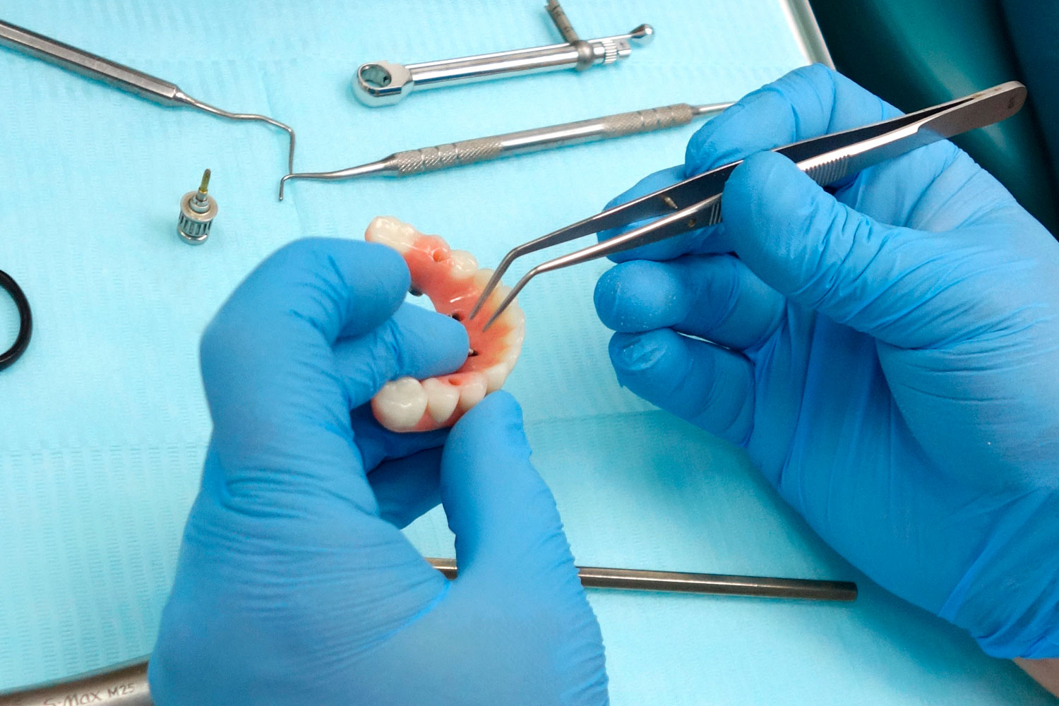 проведение коррекции зубного протеза