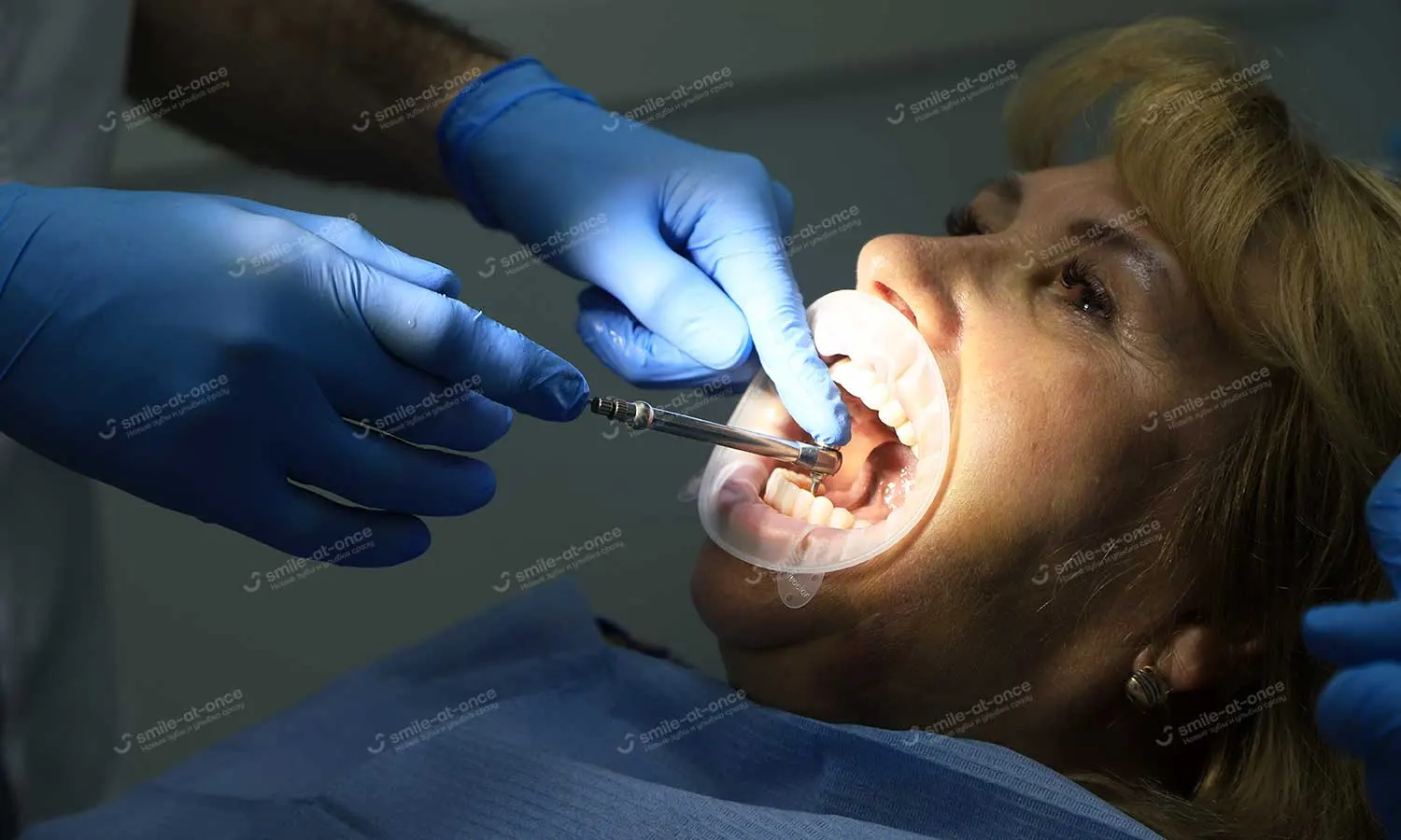 Проведение коррекции зубных протезов