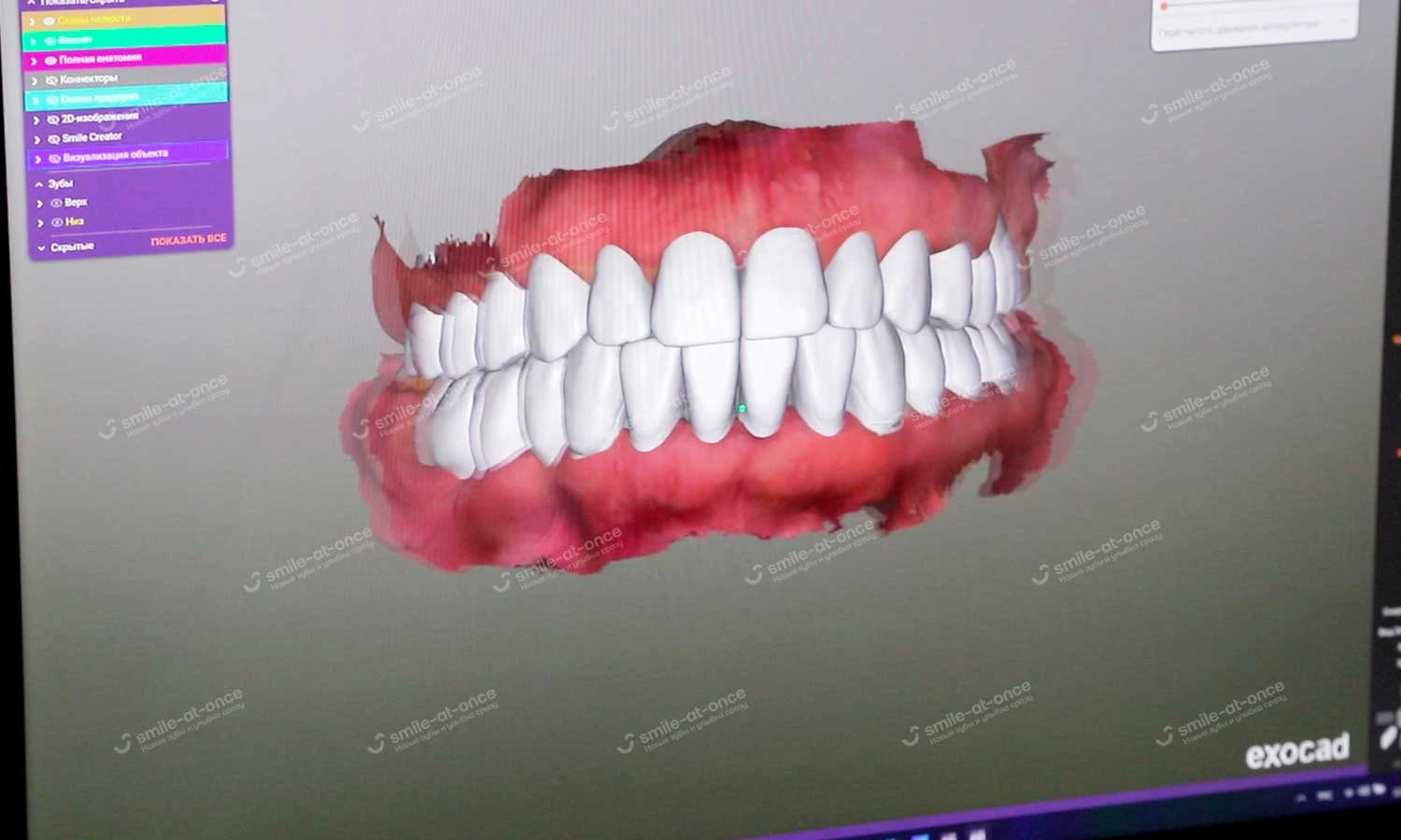 Создание 3д модели будущих зубов
