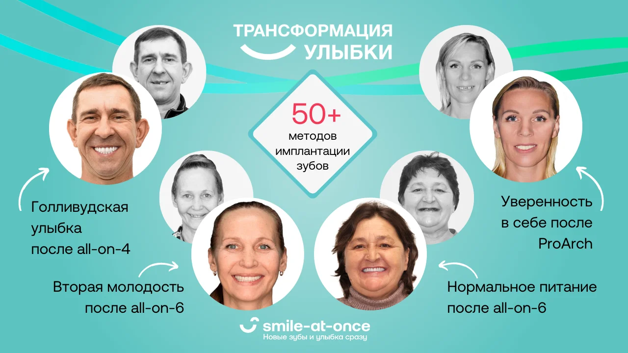 победители прошлых сезонов &laquo;Трансформация улыбки&raquo;