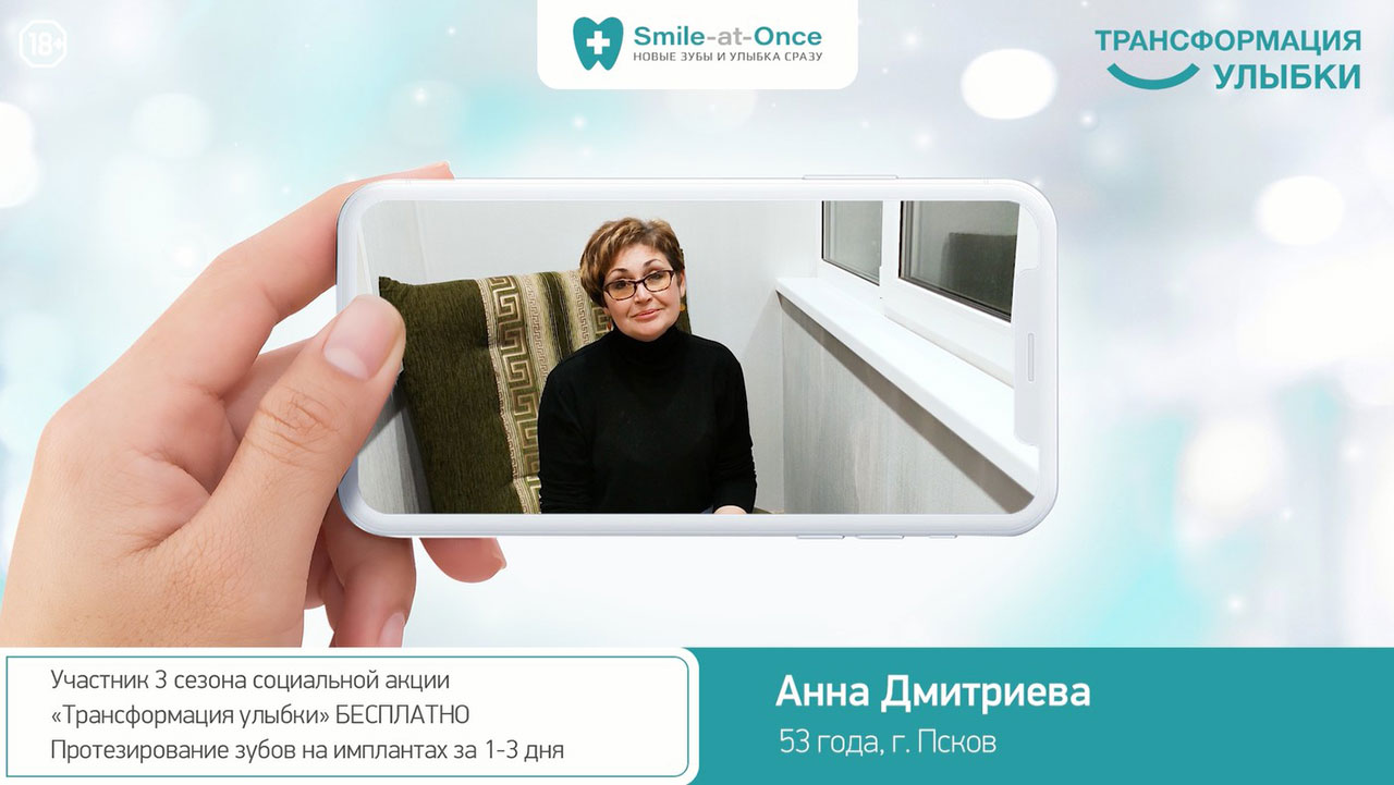 Раскладывание smile 3.